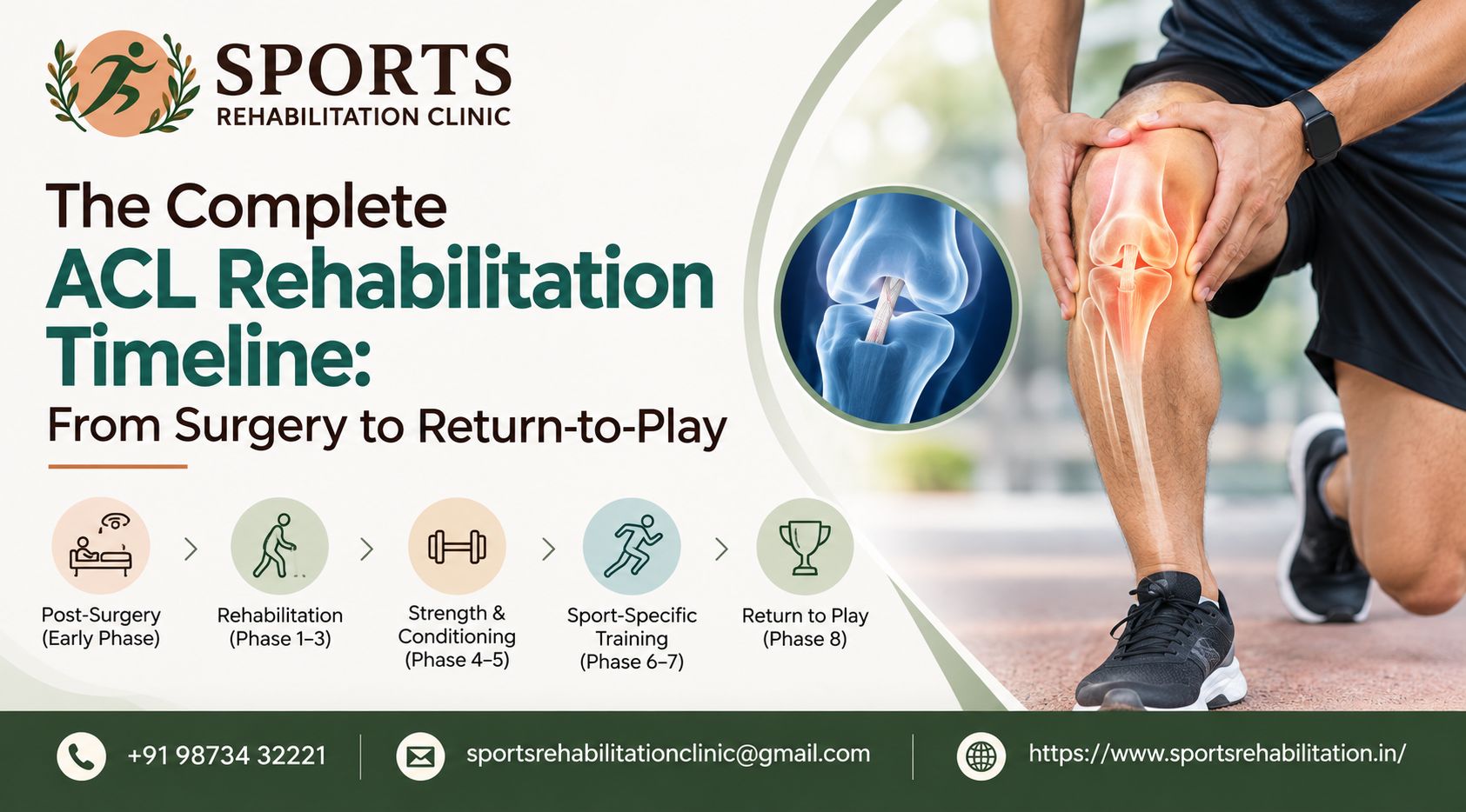 ACL Rehabilitation Timeline: Surgery to Return